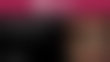 Niti S™ Esophageal Metal Stent:: Through The Scope(TTS) Stent Insertion by Dr. Giorgio Battaglia