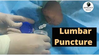 Lumbar Puncture Procedure (in just 11 mins) by Intellect Medicos 69,290 views 7 months ago 11 minutes, 13 seconds