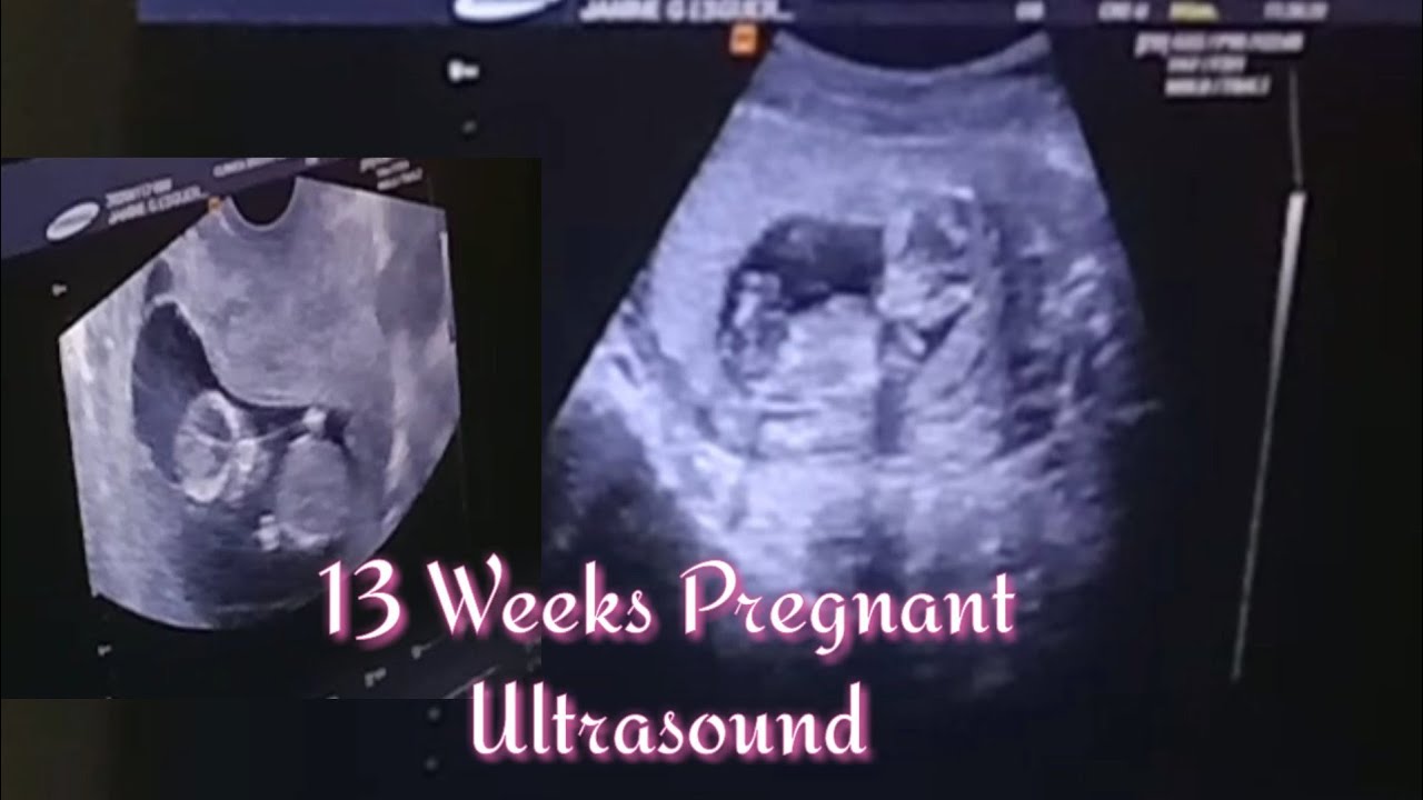 13-weeks-pregnant-ultrasound-l-janine-esguerra-youtube