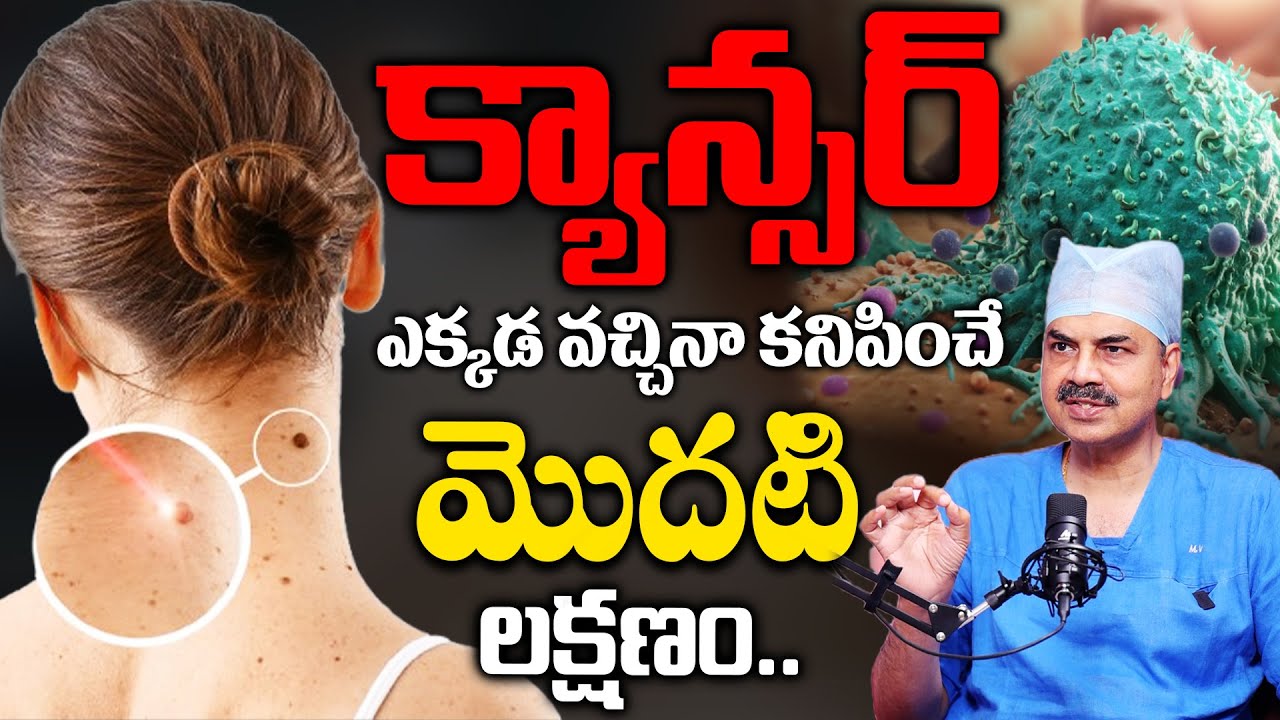 ఒంట్లో కాన్సర్ కణాలు ఉంటె కనిపించే సూచనలు || Dr.Mohan Vamsi About Cancer || Sumantv health Care