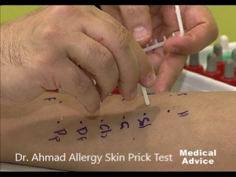Allergy Skin Prick Test by Dr. Ahmad AlKhabaz كيفية فحص الحساسية بالخدش د. أحمد الخباز