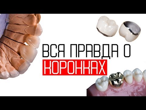 Выпуск #6. Металлокерамические коронки VS цельнокерамические (безметалл, Emax)