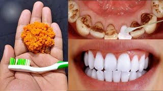 3 मिनट में दांतों से plaque / Tartar हटा कर मोतियों से जैसा सफ़ेद और चमकदार बनायें Whiten Teeth screenshot 4