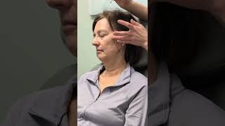 Pre-Surgical Planning for a Deep Plane Facelift