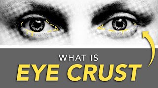 Why Are My Eyes Crusty?