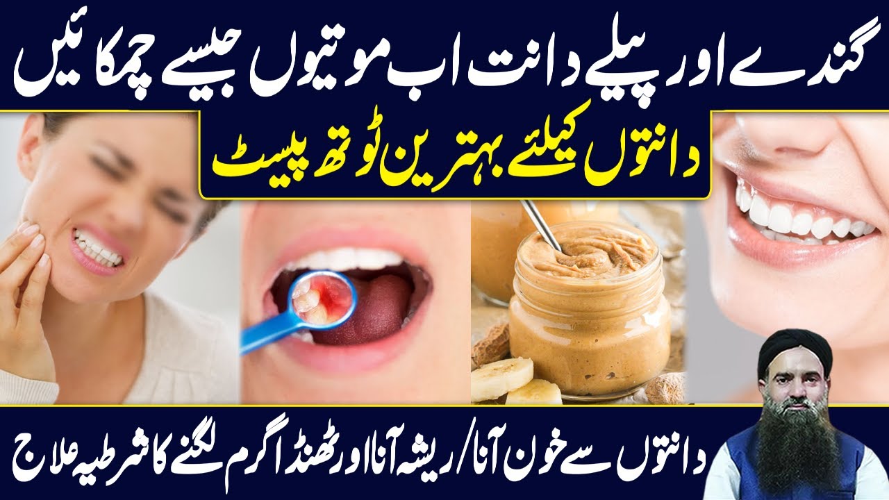 Teeth Pain Relief Home Remedy Dant/Danton/Danto Ka Dard Ka ilaj
