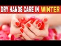 hand care tips at home in winter | hand care in winter | dry hands in winter