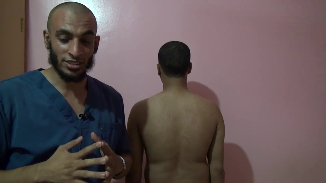 اسهل طريقه لكيفيه عد فقرات جسم الانسان اللازمه قبل دخولك لتعليم الحجامه الطبيه