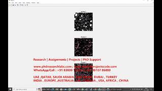 Breast Cancer tumor classification from histopathology images Mammogram cancer classification CNN
