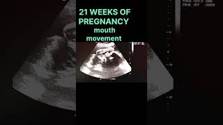 21 WEEKS OF PREGNANCY |mouth movement #motherhood #shortsfeed #mother #pregnancy #pregnancyjourney