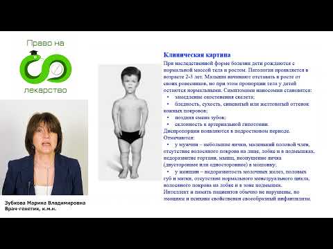 005 Гипофизарный нанизм