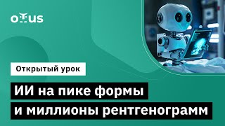 Ии На Пике Формы И Миллионы Рентгенограмм // Курс «Искусственный Интеллект (Ai) В Медицине»