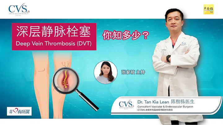 CVSKL: 腿腫脹和疼痛，小心是深層靜脈栓塞 |deep vein thrombosis | by 陳楷棟醫生 | Dr. Tan Kia Lean - 天天要聞