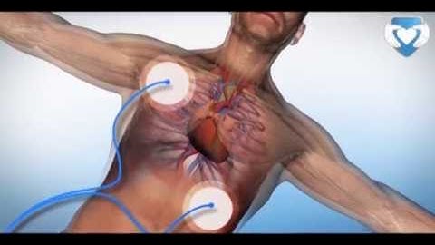 Tutorial de Reanimación Cardiopulmonar Básica (RCP y DEA) #Salvaunavida