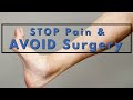 Stiff, Painful Ankle 5 Step Routine to STOP Pain, Loosen, & Avoid Surgery