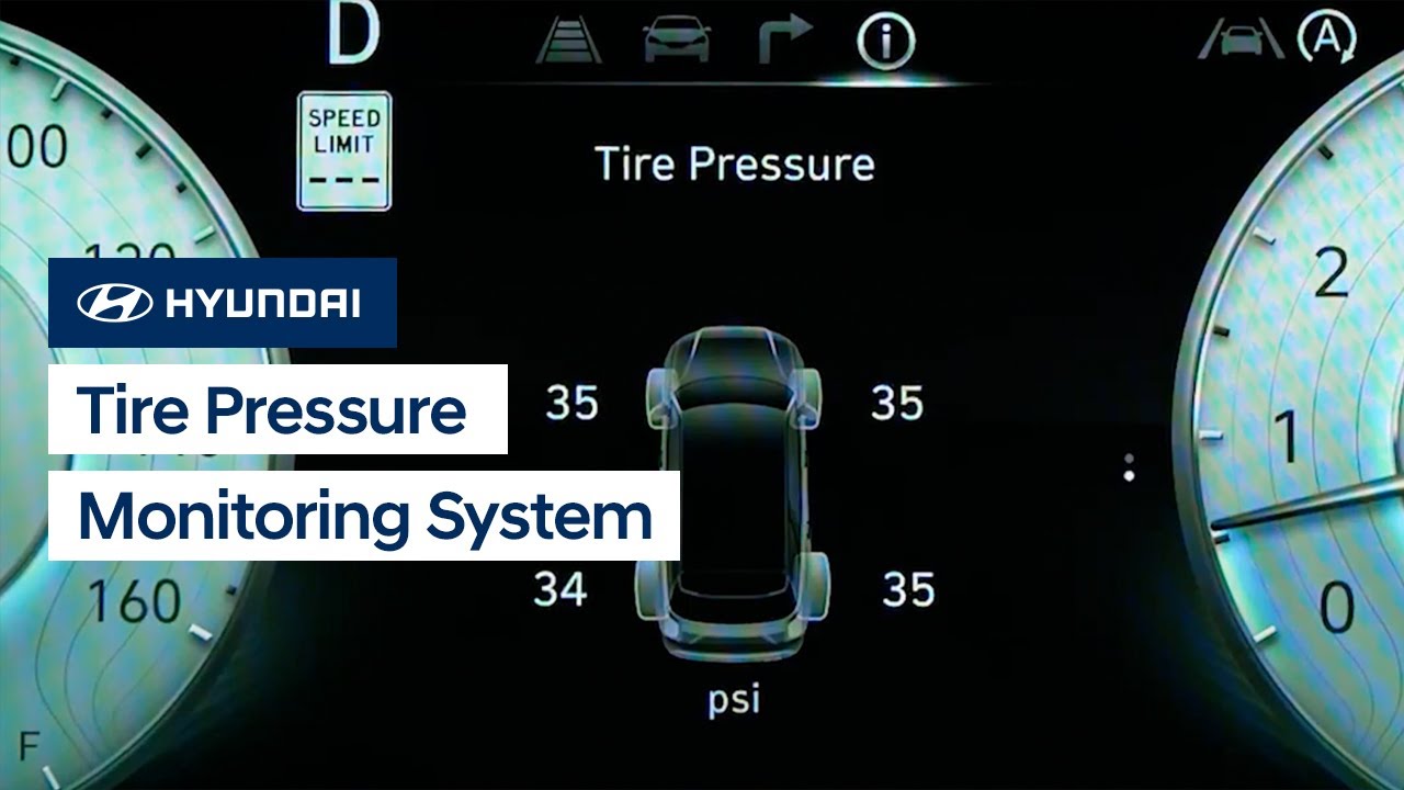 Top 5 Car Tyre Pressure Monitoring System In India