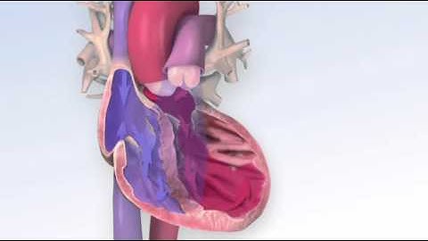 Suy tim (Heart Failure)