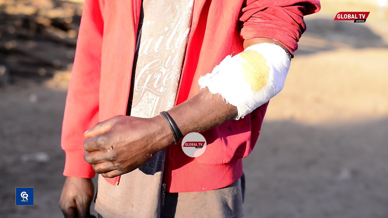 RISASI ZARINDIMA ARUSHA MCHANA KWEUPE BOSI AMPIGA RISASI MFANYAKAZI WAKE, HOSPTALI YAKATAA KUMTIBU..