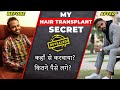 MY HAIR TRANSPLANT SECRETS REVEALED  | Before & After | Be Ghent