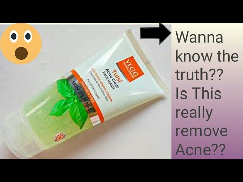 VLCC Face Wash : Review | face wash for acne pimple clearing|Review|prabhmeher|