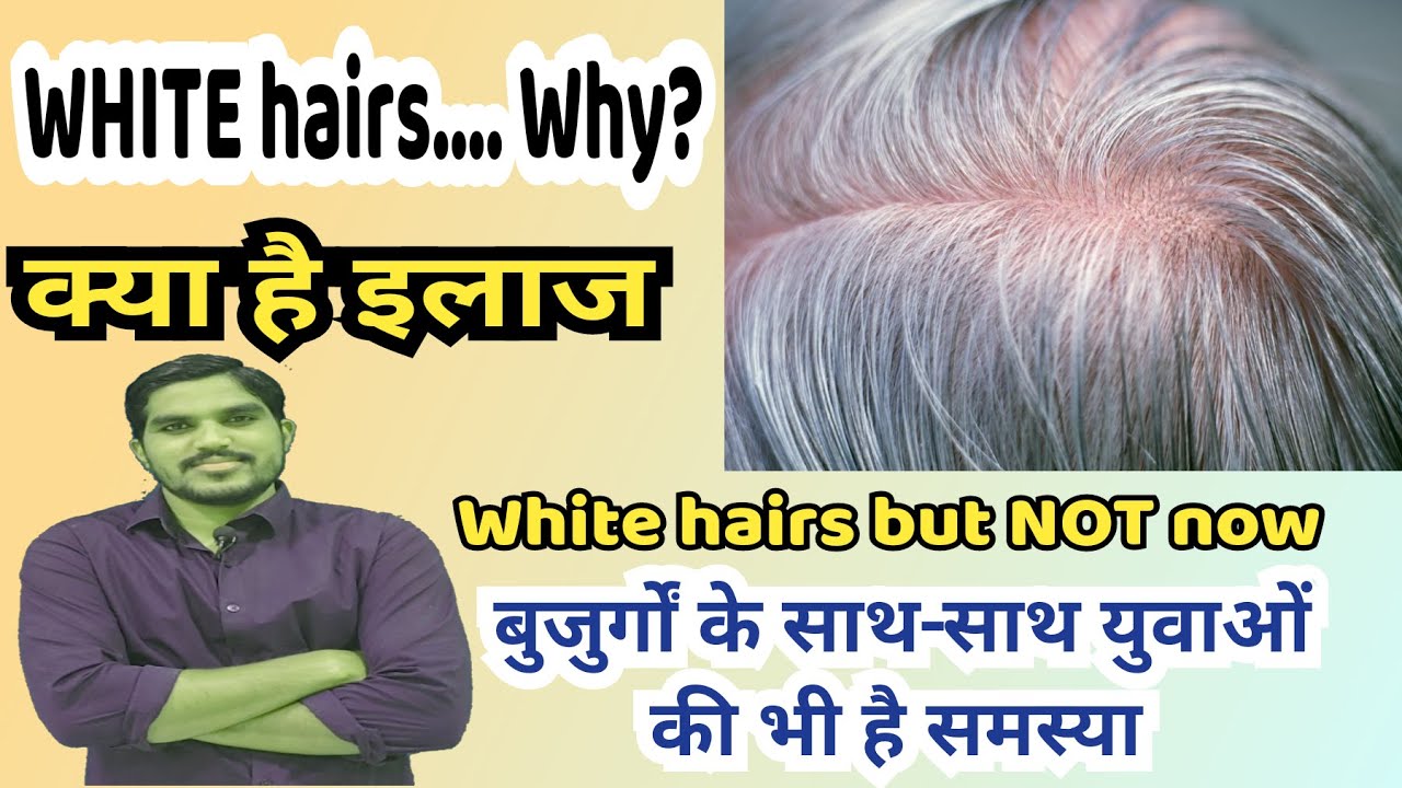 Why hairs turns white why Youngsters are having white hairs how to