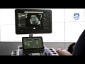 How To Use shear wave Elastography on a Philips EPIQ Ultrasound System