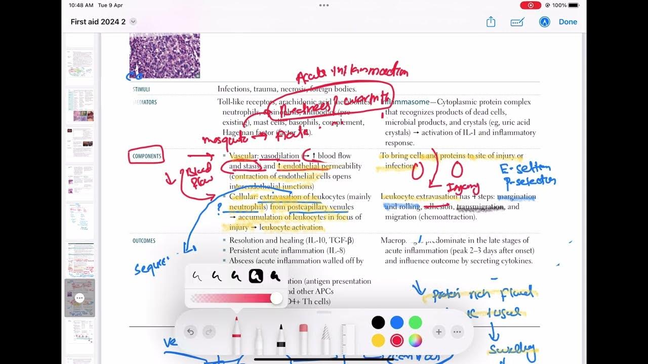 acute-inflammation-pathology-29-first-aid-usmle-step-1-in-urdu-hindi