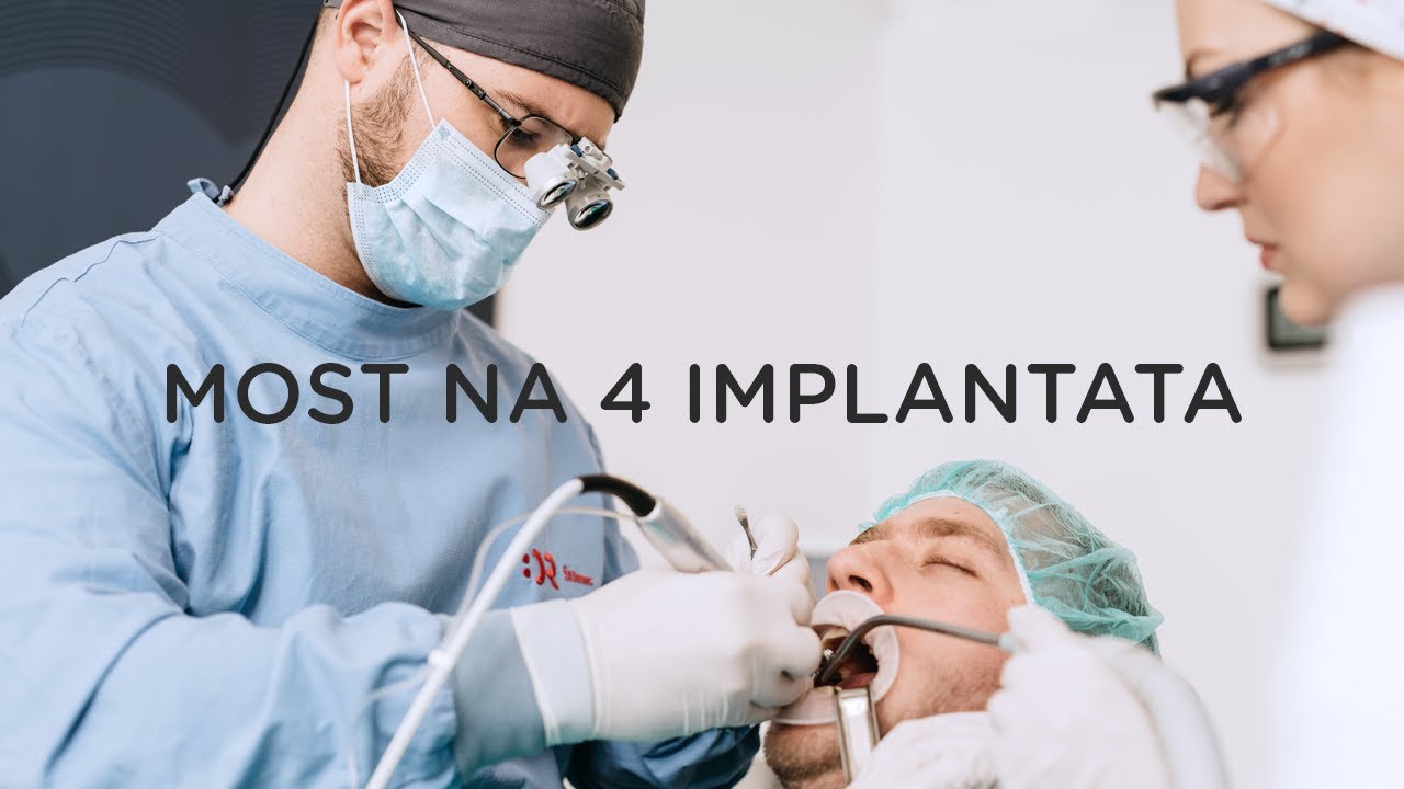 Most na 4 implantata: Case study by dr. Filip Štimac