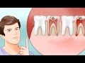 6 Proven Ways to Stop a Toothache and Relieve Pain