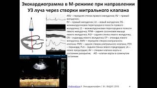 Основы ЭхоКГ. М-режим (2 часть). 10122019