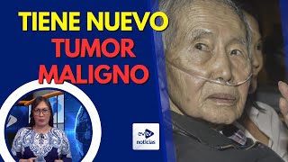 ENFRENTA OTRO CÁNCER: AHORA EN LA LENGUA | #evtvNoticias #FinDeSemana | #evtv | 05/11/24 3/3