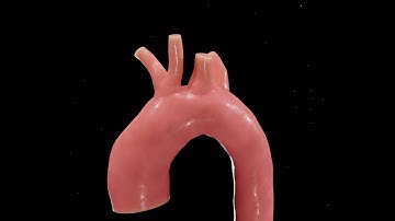 Physics-informed neural networks for blood flow inverse problems