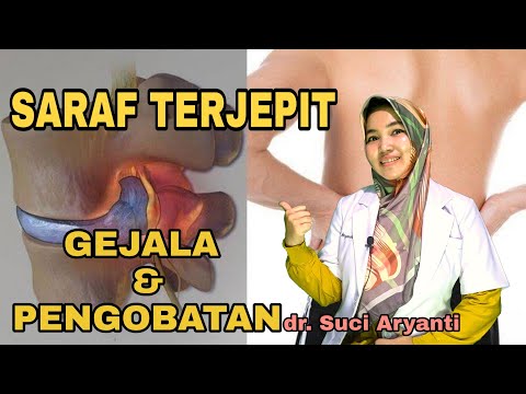 Kenali Gejala Awal Penyakit Saraf Kejepit Saraf Kejepit
