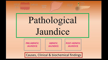 Pathological Jaundice - Types, Clinical & Biochemical Findings