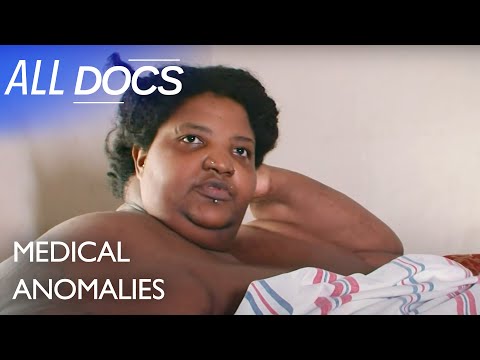 Dominique Lanoise 600 Pounds | S01 E05 | Extraordinary People Documentary | All Documentary