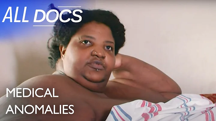 Dominique Lanoise 600 Pounds | S01 E05 | Extraordi...
