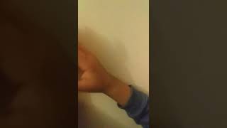 Kardeşim Parmagyny Kyrdy Hiç Birşeý Olmady