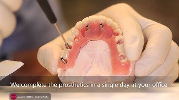 Teeth-In-A-Day by LSK121 Oral Prosthetics