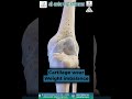 Ek Side Se Knee Pain Shuru Ho Raha Hai? ⚠️ Yeh Early Osteoarthritis Ka Sign Ho Sakta Hai |