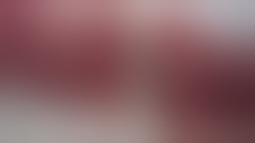 Laparoscopic Appendectomy Using the JustRight™ 5mm Stapler