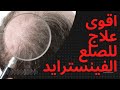 حبوب الفينسترايد لعلاج الصلع الوراثي المستشار سامي 