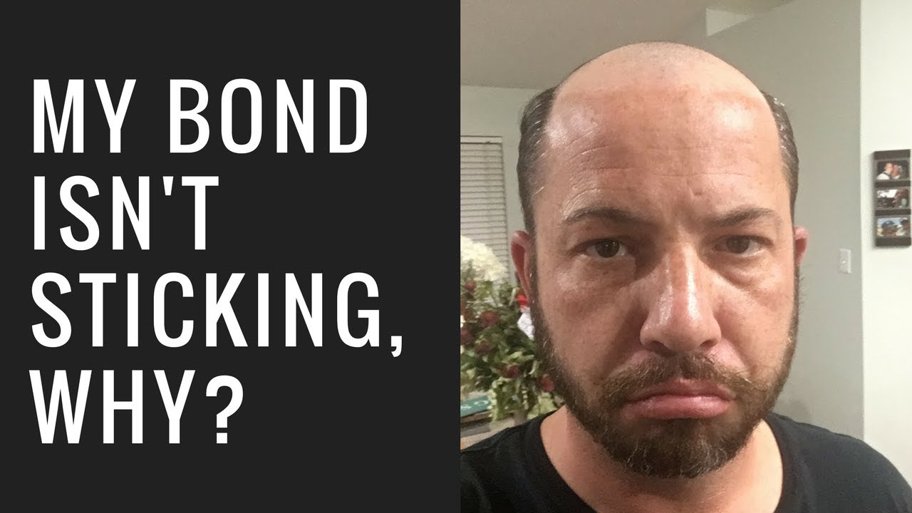 Hair Replacement Mens Hair System Review My bond isn't sticking, why