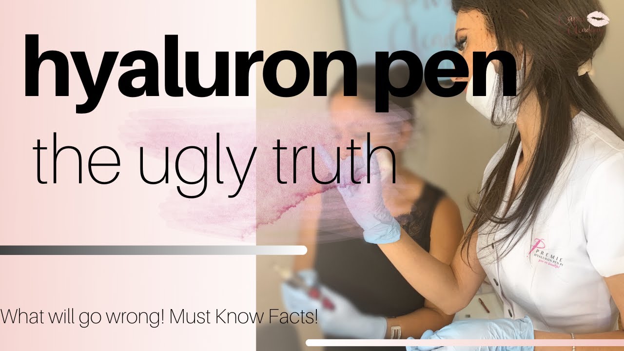 Hyaluron Pen the Ugly Truth / What will go wrong. Must Watch Facts