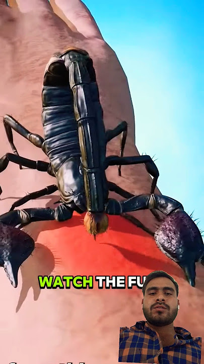 What to Do If a Scorpion Stings You #youtubeshorts #ytshorts #facts #animals #scorpion #shorts