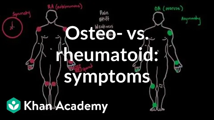 Osteoarthritis vs rheumatoid arthritis symptoms | NCLEX-RN | Khan Academy