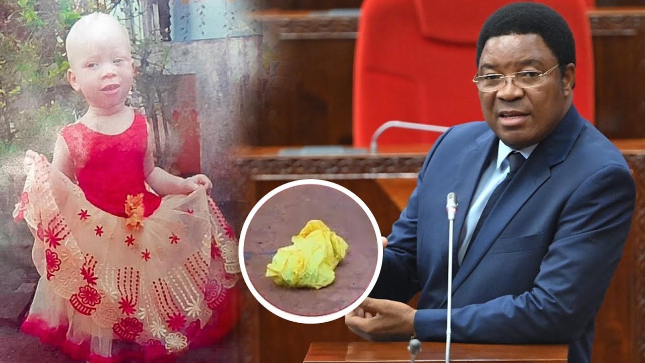 WAZIRI MKUU ATOA KAULI YA SERIKALI MAUAJI YA ALBINO, 