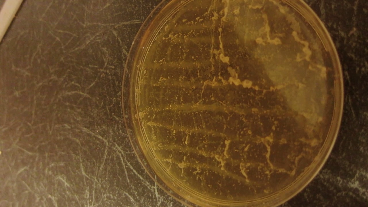 Toilet germs vs Domestos bleach