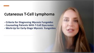 CTCL: Criteria to Diagnose, Counsel Patients, and Work-Up for Early-stage Mycosis Fungoides