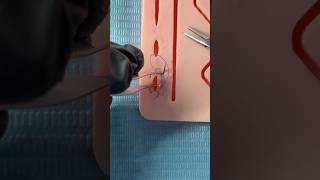 Purse string suture 👛 #shorts #viral #purse #suture #doctor