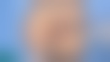 Cholecystectomy and Introduction to Colectomy Curriculum with the Simsei Simulation Program